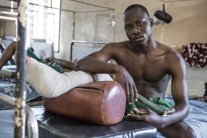 Boris, nigeriano de 28 años, tras ser intervenido en la sala de posoperatorio en el centro de salud de Lalo, especializado en úlcera de Buruli y apoyado por la ONG Anesvad. 