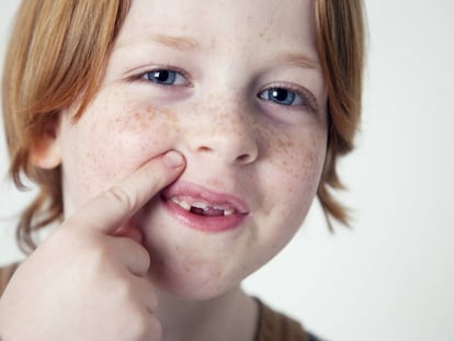 Un niño francés muestra sus dientes de leche.