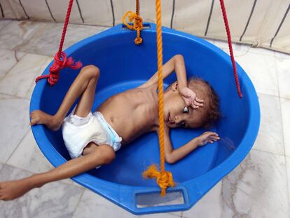 El hambre acecha a la infancia en Yemen