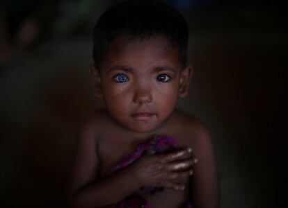 Hosne Ara, de 4 años, un refugiado rohingya que huyó de Myanmar en Cox's Bazar (Bangladés), el 5 de noviembre de 2017.