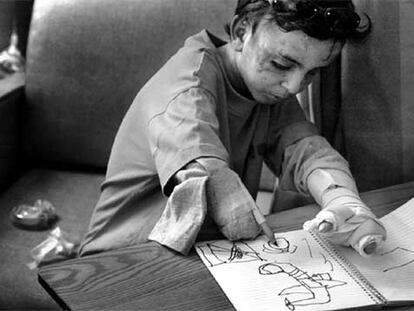 Un niño iraquí mutilado