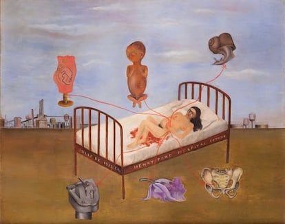 Henry Ford Hospital, Frida Kahlo