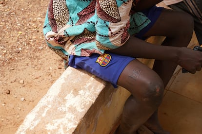 Alassane Dieudonné, uno de los cientos de niños en situación de calle en Burkina Faso, en julio de 2021 en el patio del Centro de Acogida y Urgencia de la Asociación Tié y NouSol ONG, ubicado al sector 15 de la ciudad de Bobo-Dioulasso. Los llamados 'enfants de la rue' (niños de la calle) se suelen tatuar con aceite de anacardo. Dieudonné lleva el número 575 en la pierna.