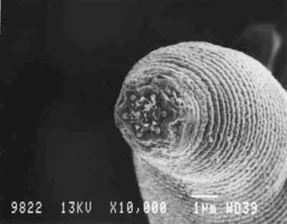 Una imagen del 'Halicephalobus mephisto', un gusano que viven en las entrañas de la Tierra.