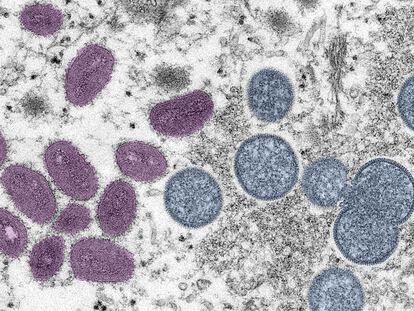 Imagen de microscopía electrónica de una partícula de la viruela del mono.