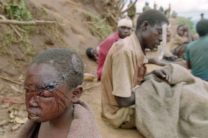 El mayor genocidio registrado en el mundo, según la ONU, comenzó la noche del 6 de abril de 1994, sólo horas después de que el presidente del país, Juvenal Habyarimana, muriera, cuando fue alcanzado por dos misiles el avión en el que se disponía a aterrizar en el aeropuerto de Kigali. En la imagen, un niño con una gran herida en el rostro, descansa en un campamento de refugiados cerca de Kibeho en Ruanda, 1995.