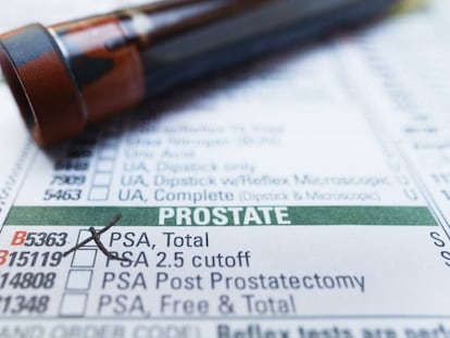 The prostate gland performs many functions.