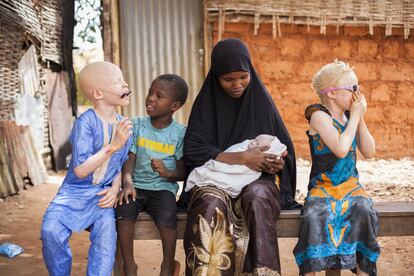 Nafi Cissé, junto a sus hijos Aisha, Lucmani y Moussa, sujeta con delicadeza la cabeza de su pequeño recién nacido Sumaila enfrente de la casa familiar de los Darramé en el barrio de Missira, en Bissau. Aunque ella no lo sabía, tiene el gen recesivo del albinismo al igual que su marido Issa Darramé, que tampoco es albino pero tres de sus hermanos sí. La combinación de ambos hace que sus hijos puedan presentar esta alteración genética o no.