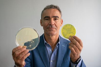 O microbiologista Bruno González Zorn mostra dois cultivos bacterianos em sua sala na Universidade Complutense de Madri.