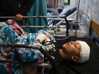 Un niño herido, en un hospital de Jan Yunis, en el sur de la franja de Gaza, este martes.
