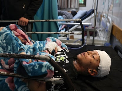 Un niño herido, en un hospital de Jan Yunis, en el sur de la franja de Gaza, este martes.