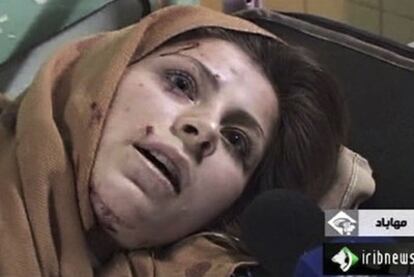 Captura de una imagen de un vídeo de la televisión iraní que muestra una mujer herida en un atentado en la ciudad de Mahabad.