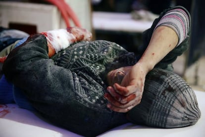 Un hombre herido espera a ser atendido en un centro médico en Douma (Siria).