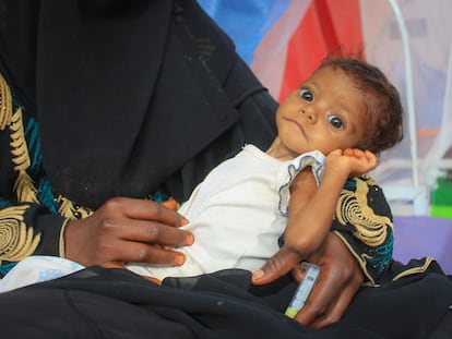 Una mujer sostiene en brazos a su hijo, que recibe tratamiento en el departamento de desnutrición de la ciudad de Hajjah, en Yemen.