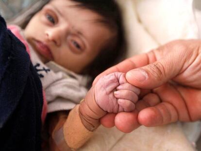 Una enfermera toma de la mano a una bebé de dos meses malnutrida dos días antes de morir, en el centro de Saná, en Yemen.