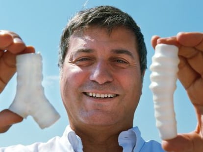 Paolo Macchiarini en 2011, cuando implant&oacute; las primeras tr&aacute;queas biosint&eacute;ticas.