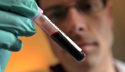 El test consiste en detectar la evolución de la presencia de una proteína en la sangre.