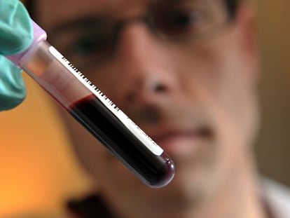 El test consiste en detectar la evolución de la presencia de una proteína en la sangre.