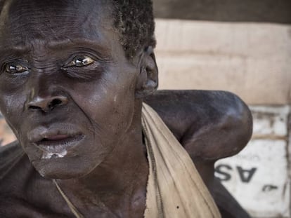 Como tantos sudaneses del sur, esta anciana sufre de inanición. Desde la crisis de 2013, los dos bandos rivales mantienen un enfrentamiento que ha costado al país una guerra civil, combates, enfermedades y hambre.