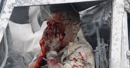 Uno de los militares italianos heridos en la explosión