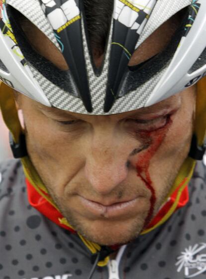 Armstrong, herido tras su caída en la Vuelta a California.
