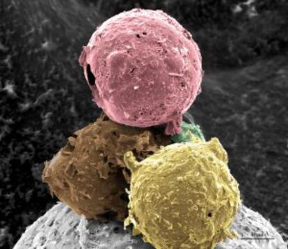 Fotografía 'Bolas de Helado', primer premio en la categoría Micro del certamen Fotciencia 2011