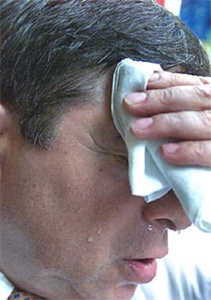 Entre el 0,5% y el 1% de la población padece hiperhidrosis localizada.