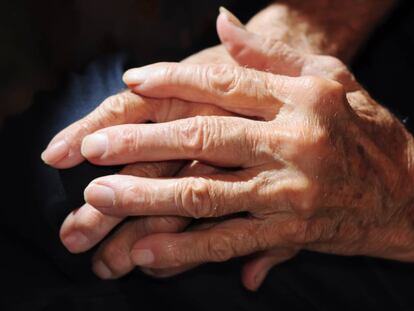 Las manos con artrosis de un hombre.