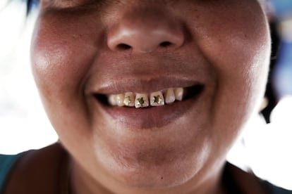 La mujer de un buscador de oro sonríe mostrando oro en sus dientes.