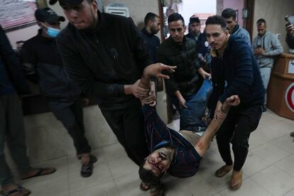 Un palestino herido por un bombardeo israelí es traladado al hospital en Deir al Balah, en la franja de Gaza, este martes.