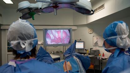 Operación de retirada de un quiste en el ovario de una mujer con endometriosis en un hospital en Niza (Francia).