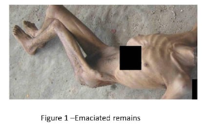Los restos de un detenido en estado de desnutrición.