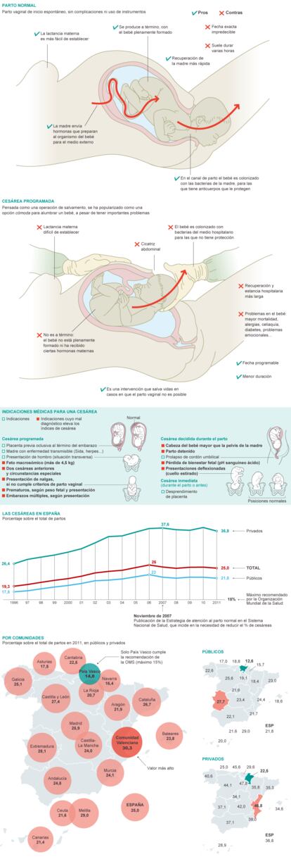 Fuentes: Ministerio de Sanidad, Organización Mundial de la Salud, El Parto es Nuestro, Txanton Martínez-Astorquiza (Director de Ginecología del Hospital de Cruces, Bilbao) y elaboración propia.