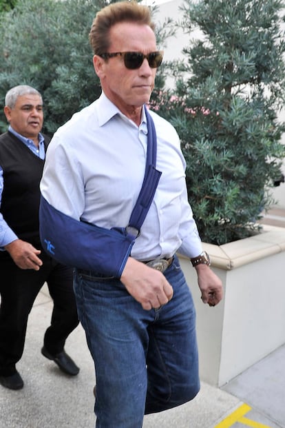 Arnold Schwarzenegger, cuando cambió el cine por la política, se vio obligado a acudir a actos públicos con el brazo lesionado.