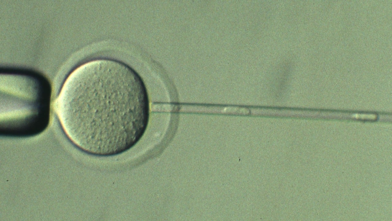 Extracción de material genético de una célula.