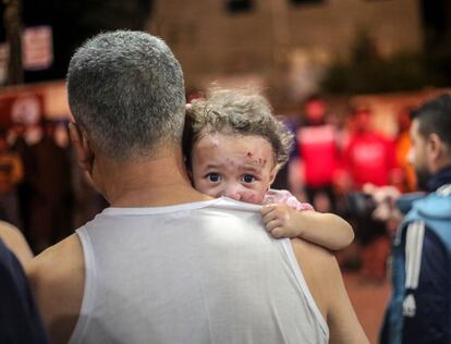 Un menor herido en un bombardeo israelí en Jan Yunis era trasladado este martes a un hospital. 