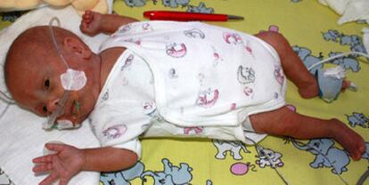 El niño prematuro nacido en Alemania en septiembre del año pasado, con tres meses de vida.
