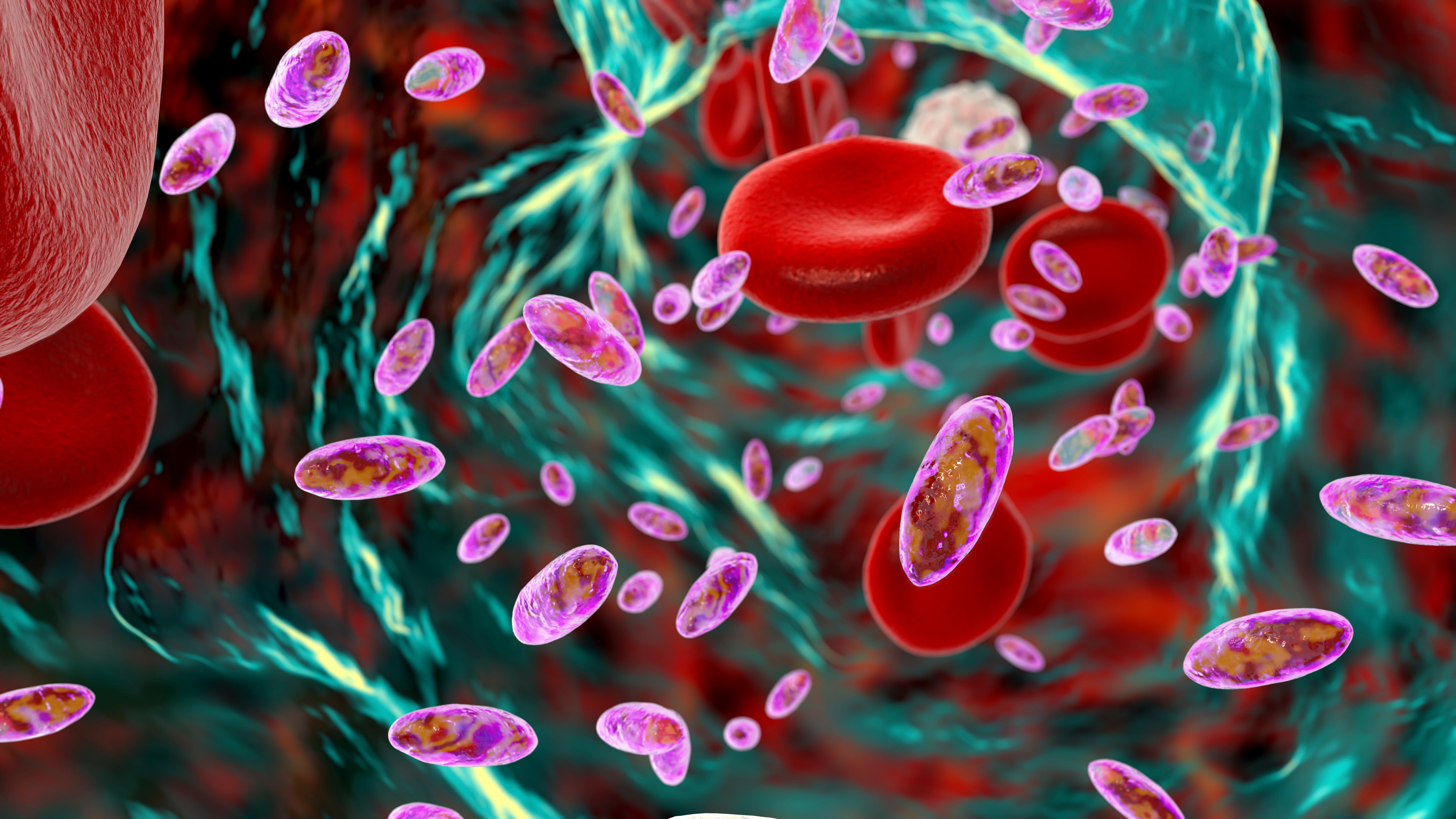 IA para reducir las muertes por sepsis