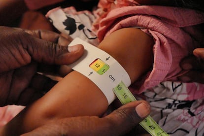 A specialist from the UN World Food Program tests a child for malnutrition in Omdurman, Sudan.
