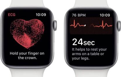 Electrocardiogramas en los Apple Watch.