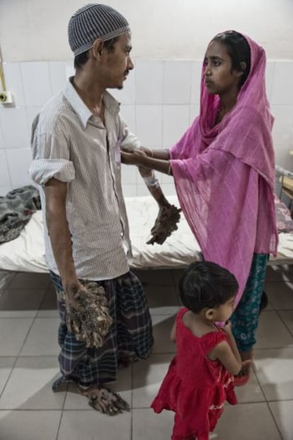 Halima arregaça a manga da camisa de seu marido, que não pode fazer praticamente nada sem ajuda. Ele deseja sentir o toque de sua filha de três anos.