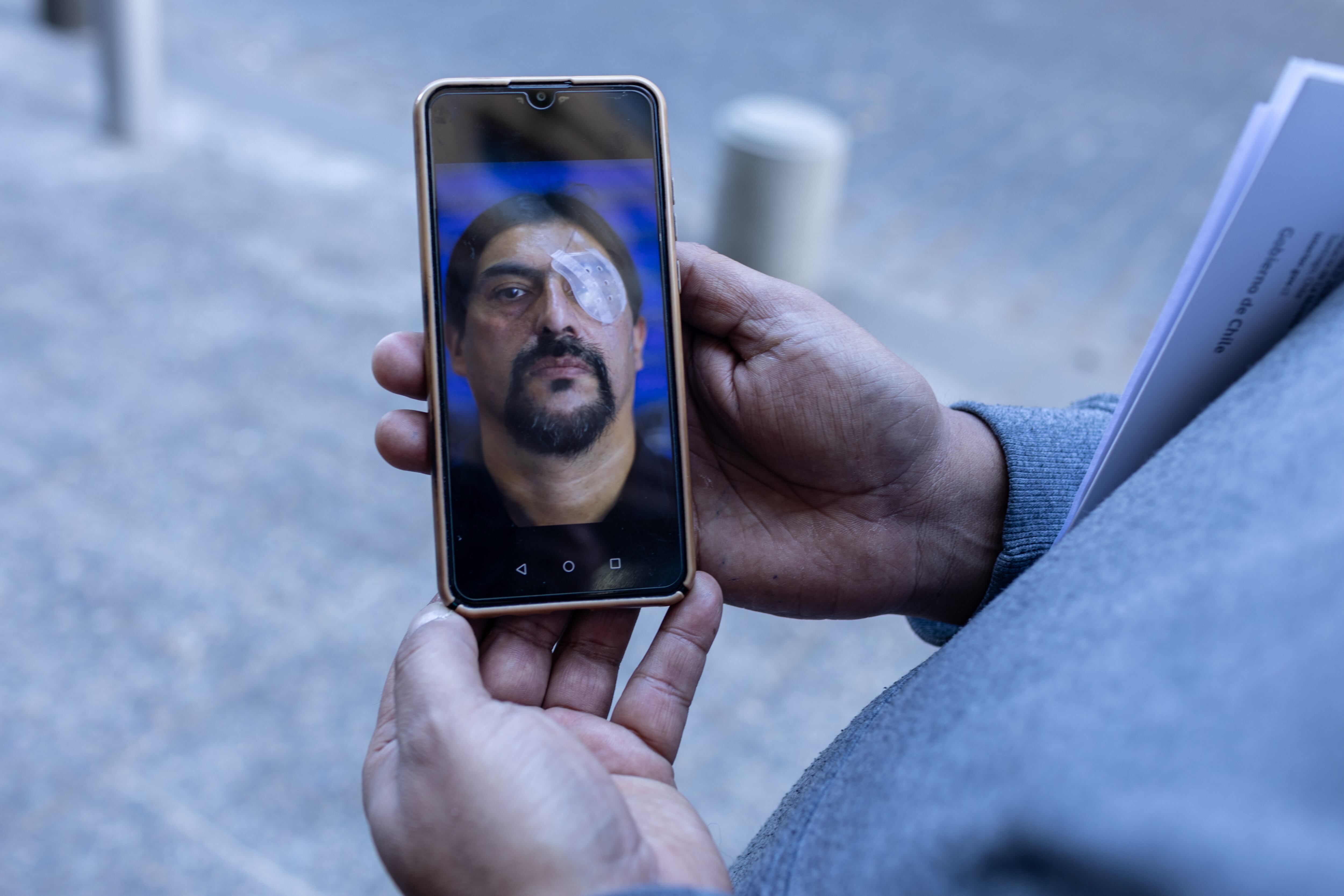 Nelson Iturriaga, herido durante el estallido social en Chile del año 2019, muestra una fotografía en su celular de ese periodo. 