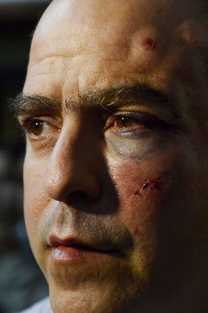 El diputado opositor Julio Borges magullado por las agresiones.