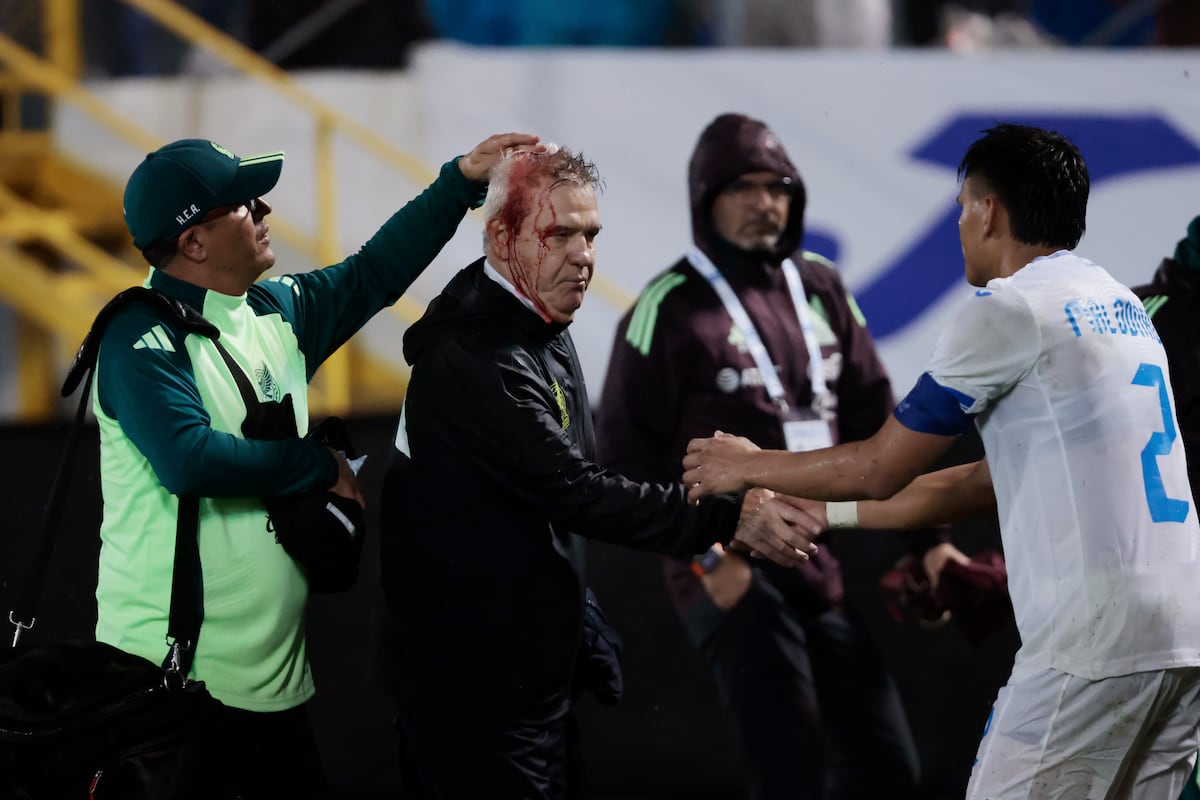 Javier Aguirre or when the head bleeds with sportsmanship