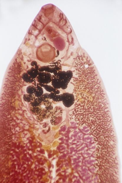 The parasite.