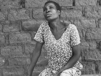 Mageni Benge, retratada en frente de su casa en la provincia de Mwanza en el norte de Tanzania. Lleva en su cara las cicatrices de un ataque ordenado por su propio hermano, a quien un curandero convenció de que era una bruja y era responsable de la muerte de sus padres.