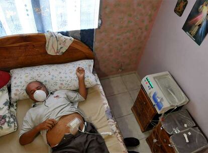 El panameño Adolfo Nieto, envenado por el jarabe, recibe diálisis en su casa, el pasado mes de julio.