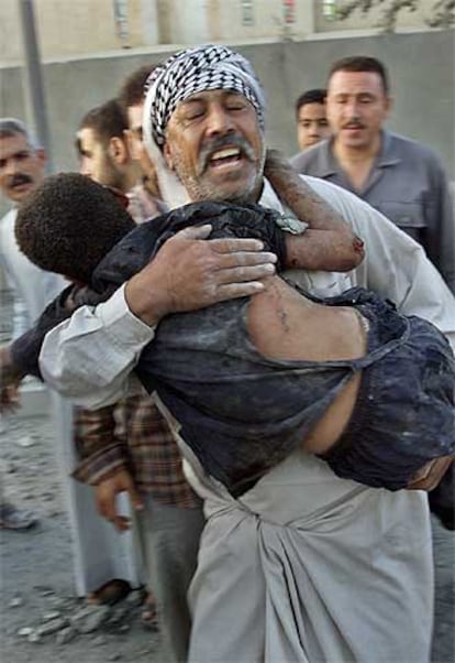 Iraquí con su hijo herido, en Faluya.