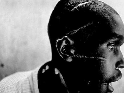 "Los machetes o, como se conocen en gran parte de África, <i>pangas",</i> escribe Jon Lee Anderson, "son uno de
los instrumentos de guerra más comunes". La fotografía, realizada en Ruanda en 1994, muestra las mutilaciones de machete sufridas por un miembro de la etnia hutu.
