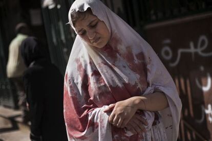 Una mujer herida abandona un hospital en Alepo, en una foto de 2012.